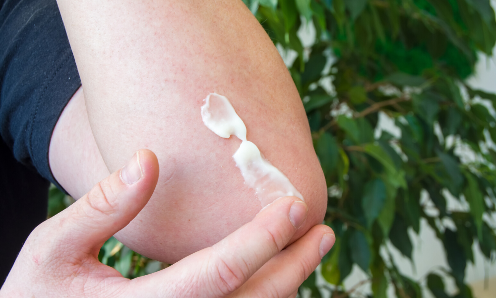 Psoriasis and Eczema: Understanding the Difference