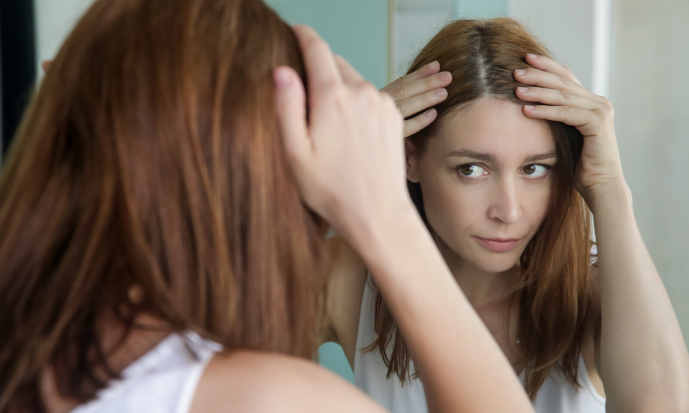 How to Tell the Difference Between Scalp Psoriasis vs. Dandruff